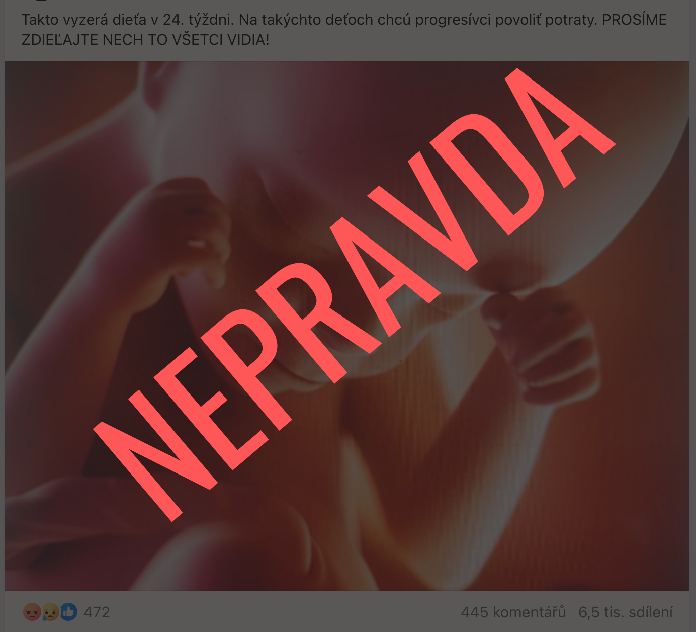 Progresívne Slovensko nechce měnit dobu pro legální potraty